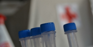 CVP disponibilizou cerca de 100 mil testes à Região Autónoma da Madeira